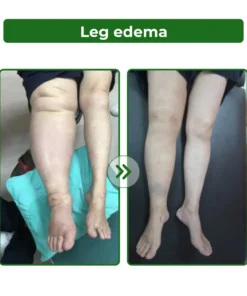 Dobshow® Lymphatic Detox Herbal Cream