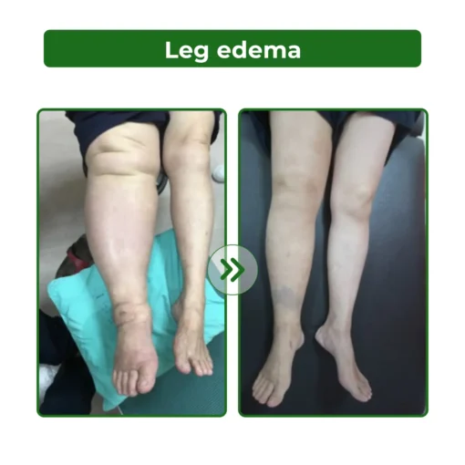Dobshow® Lymphatic Detox Herbal Cream