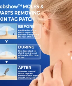 Dobshow™ Moles & Warts Removing Skin Tag Patch