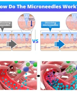 Dowshow® Nano Microneedle Patch with SMGT-GLP-1 & Matrixyl 3000