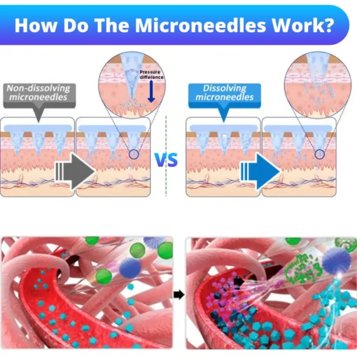 Dowshow® Nano Microneedle Patch with SMGT-GLP-1 & Matrixyl 3000
