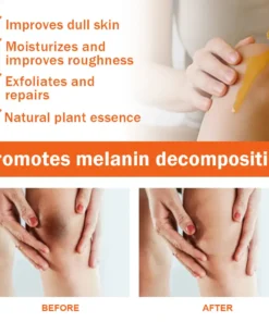 Dobshow® Acanthosis Nigricans Treatment Oil