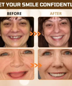 Dobshow® Adsorptive Denture