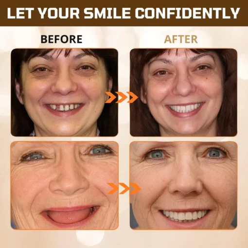 Dobshow® Adsorptive Denture