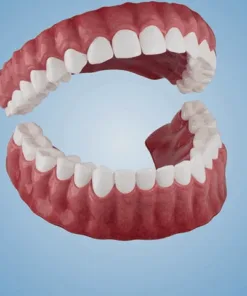 Dobshow® Adsorptive Denture