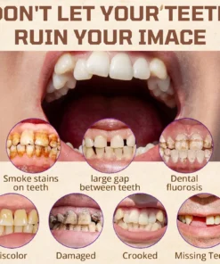 Dobshow® Adsorptive Denture