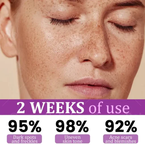 Dobshow® MelantraX Advanced Anti-Hyperpigmentation Essence