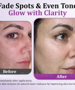 Dobshow® MelantraX Advanced Anti-Hyperpigmentation Essence