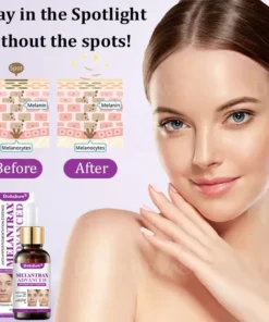 Dobshow® MelantraX Advanced Anti-Hyperpigmentation Essence