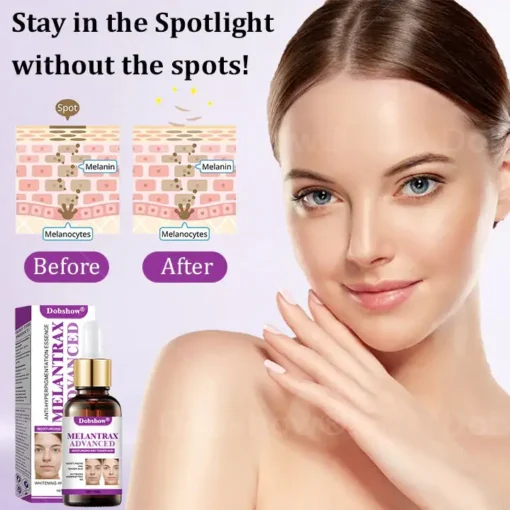 Dobshow® MelantraX Advanced Anti-Hyperpigmentation Essence