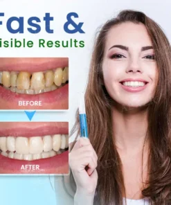 Dobshow™ Teeth Whitening Pen