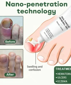 Dobshow® Nail Fungus Renewal Gel