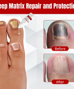 Dobshѳw® MycoClear Nail Renew Extra Strength