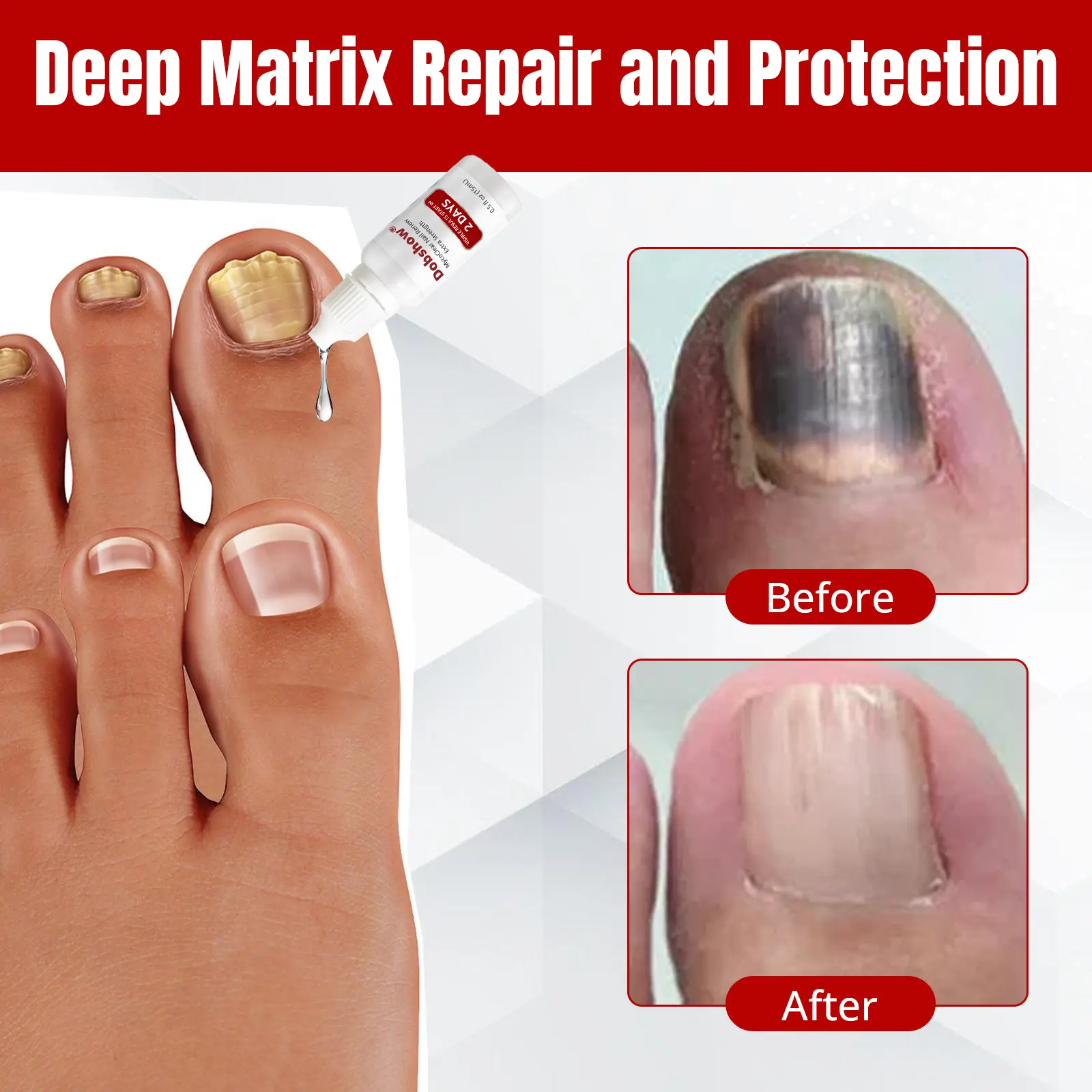 Dobshѳw® MycoClear Nail Renew Extra Strength