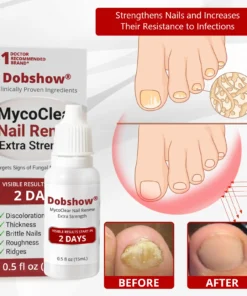 Dobshѳw® MycoClear Nail Renew Extra Strength