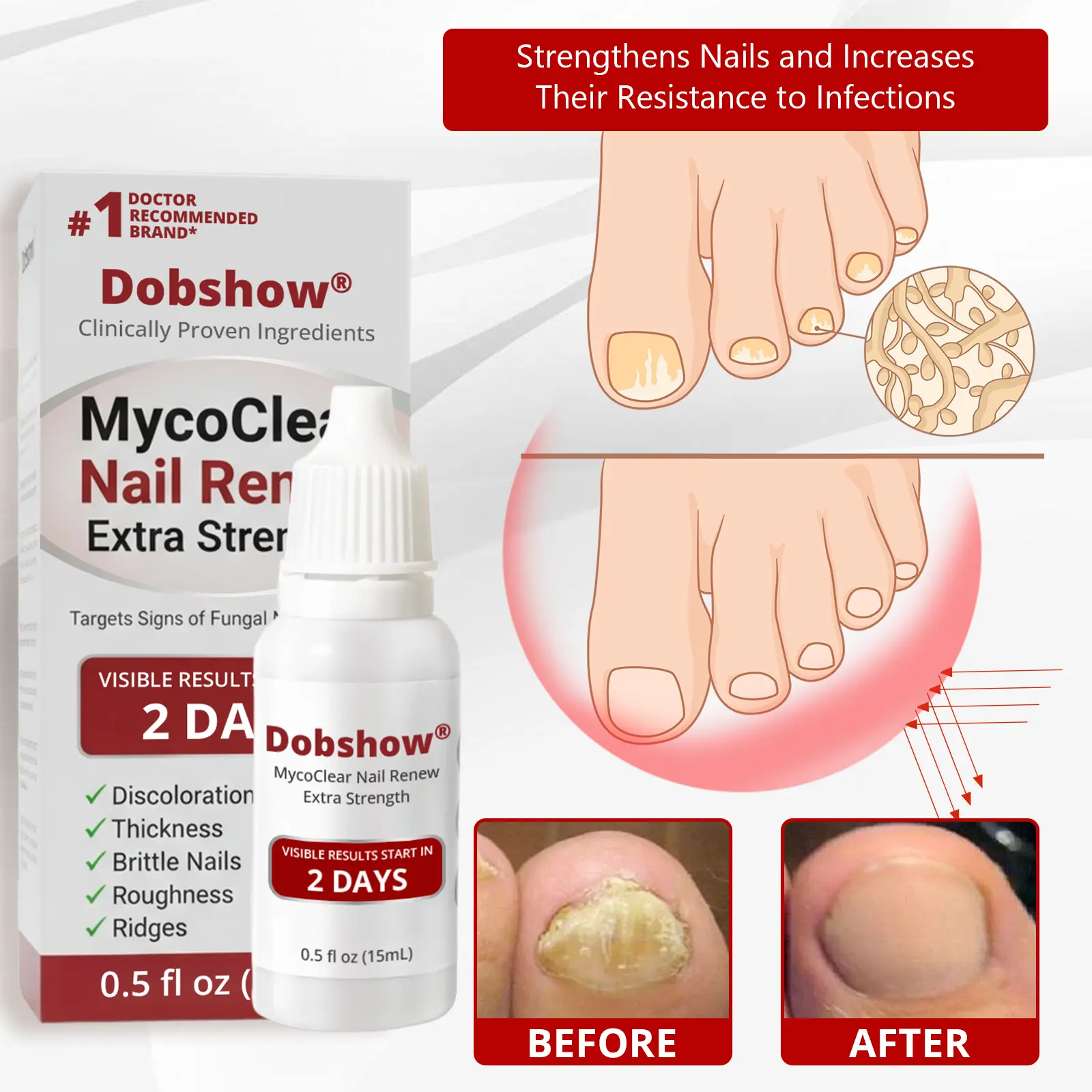 Dobshѳw® MycoClear Nail Renew Extra Strength