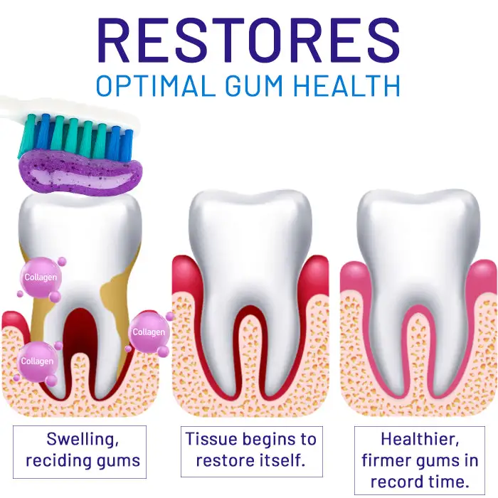 Dobshow® Collagen Fresh-Gum Renew Toothpaste