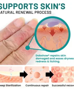 Dobshow® Probiotic + B 24-7 Moisture Eczema Relief Cream