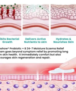 Dobshow® Probiotic + B 24-7 Moisture Eczema Relief Cream