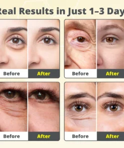 Dobshow® The 7-Day V-Line Shot: Vita A Retinal Tightening Serum