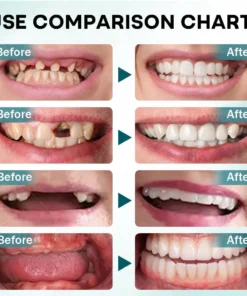 Dobshow® FirmHold Denture Adhesive