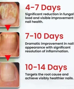 Dobshow® Fungi-Cure Max Triple-Action Formula: Penetrates Deep to the Nail Root, Eradicates Fungus & Restores Healthy Growth
