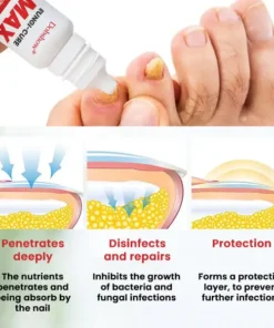 Dobshow® Fungi-Cure Max Triple-Action Formula: Penetrates Deep to the Nail Root, Eradicates Fungus & Restores Healthy Growth