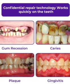 Dobshow® Dental Repair Mineral Powder Buy 1 Get 1 Free