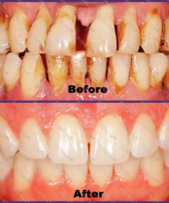 Dobshow® ApiCore BeeVenom Vital Repair Toothpaste