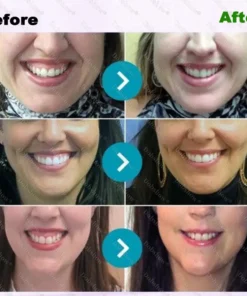 Dobshow® ApiCore BeeVenom Vital Repair Toothpaste