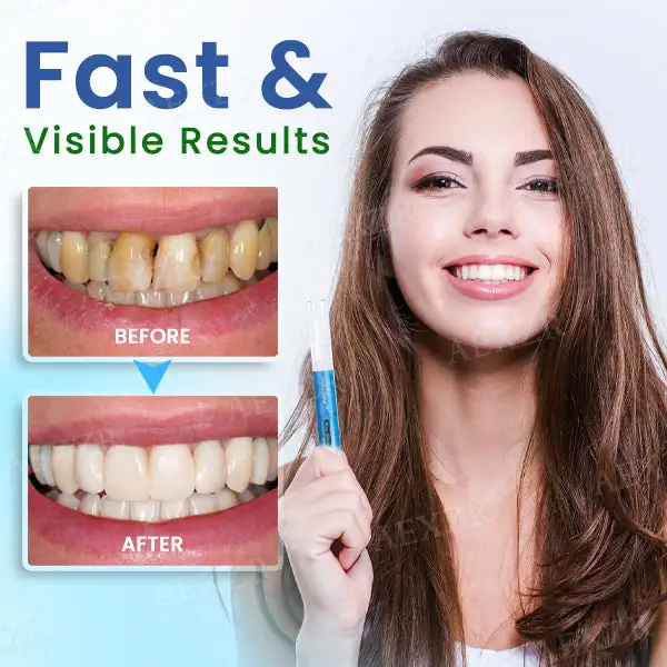 Dobshow®Teeth Whitening Pen