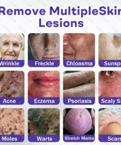 Dobshow® Wart and mole removal microneedle patch