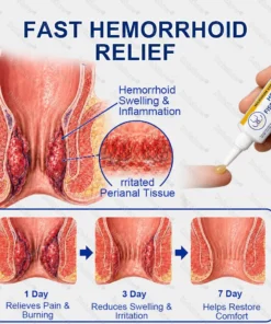 Dobshow® Hemorrhoid & Fissure Relief Ointment