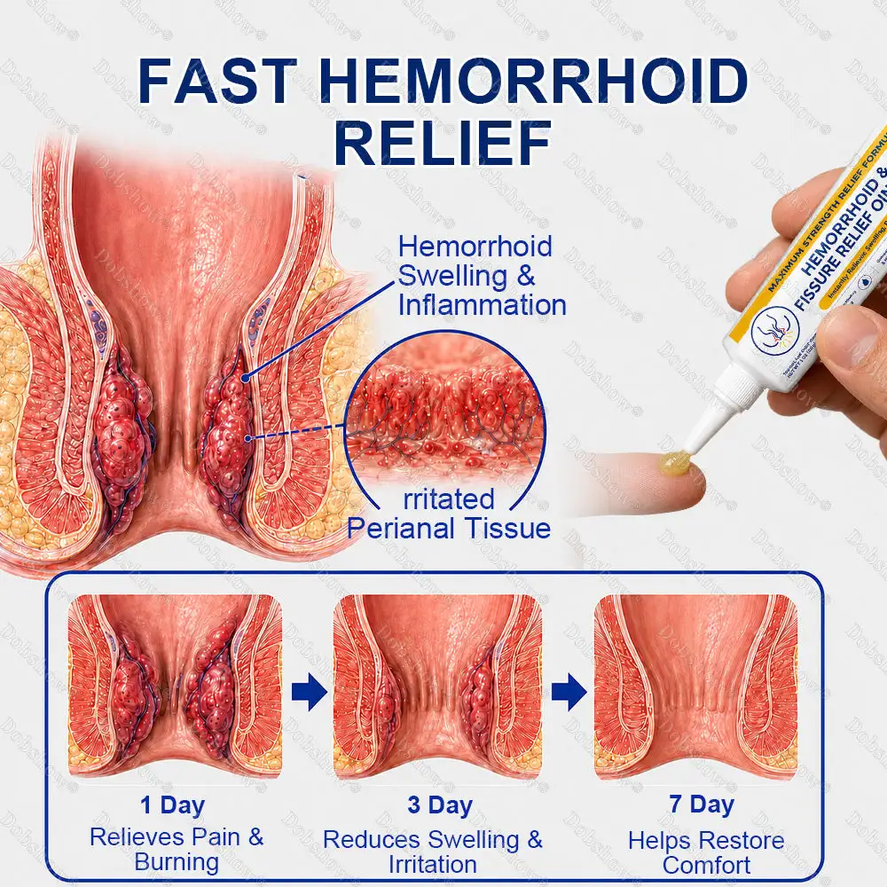 Dobshow® Hemorrhoid & Fissure Relief Ointment