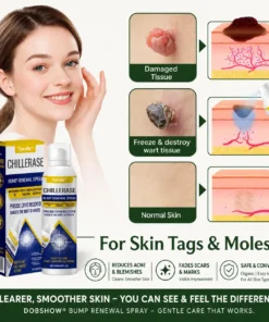 Dobshow® 2-in-1 Cryo-Cooling Bump Renewal Spray