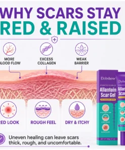 Dobshow® Allantoin Scar Gel