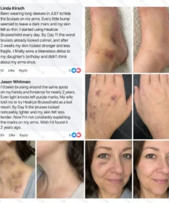 Dobshow® BRUISESHIELD Skin Strengthening Cream