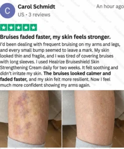 Dobshow® BRUISESHIELD Skin Strengthening Cream