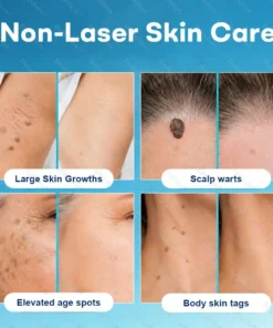 Dobshow® 7-Day Blemish Remover Pain-Free & Scar-Free Advanced Roller Pen for Skin Tags and Spots