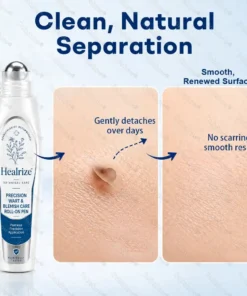 Dobshow® 7-Day Blemish Remover Pain-Free & Scar-Free Advanced Roller Pen for Skin Tags and Spots