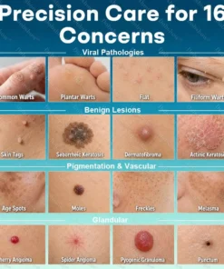 Dobshow® 7-Day Blemish Remover Pain-Free & Scar-Free Advanced Roller Pen for Skin Tags and Spots