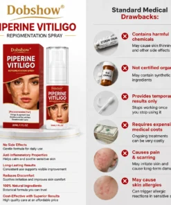 Dobshow® Advanced Piperine Vitiligo Repigmentation Spray