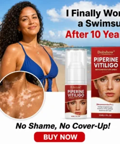 Dobshow® Advanced Piperine Vitiligo Repigmentation Spray