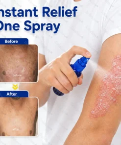 Dobshow® Advanced Psoriasis Relief Spray