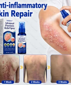 Dobshow® Advanced Psoriasis Relief Spray