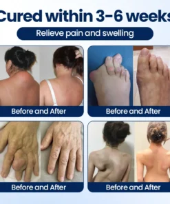 Dobshow® ArthriNAD+ Pro Advanced Joint Recovery Cream