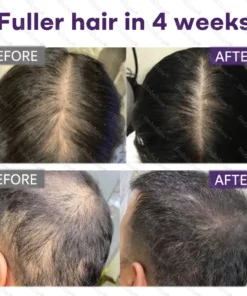 Dobshow® Black Rice & Red Onion Hair Growth Spray