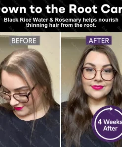 Dobshow® Black Rice & Red Onion Hair Growth Spray