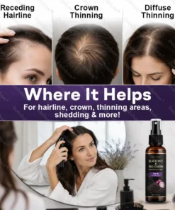 Dobshow® Black Rice & Red Onion Hair Growth Spray