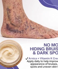 Dobshow® Dark Spot & Bruise Recovery Cream